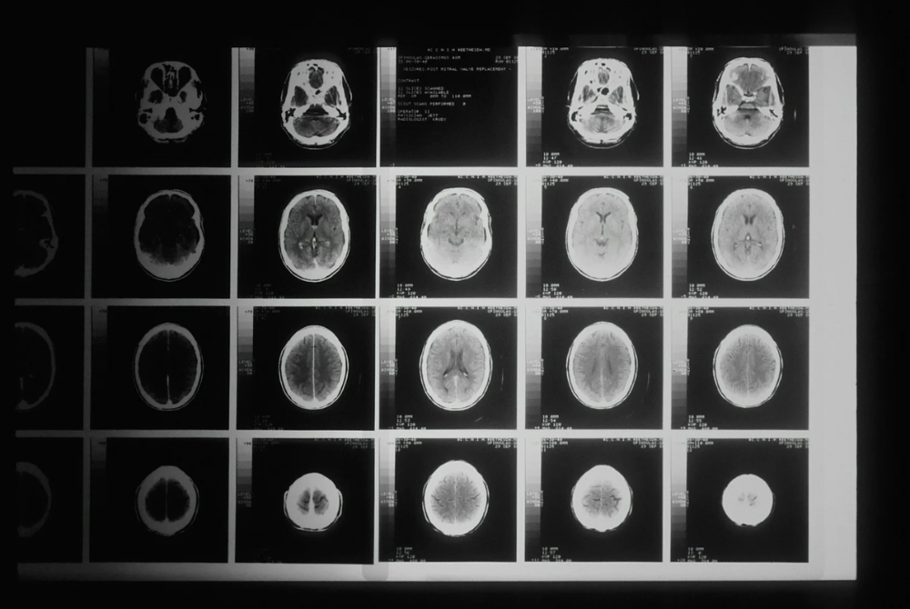 A Lawyer’s Guide to Traumatic Brain Injuries in North Carolina